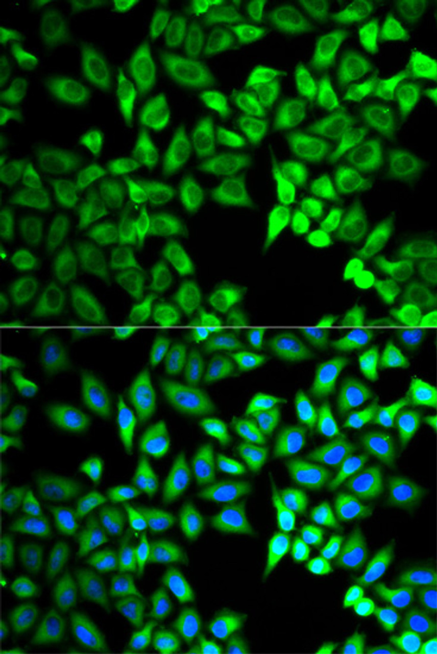 Immunofluorescence analysis of A549 cells using C10orf2 antibody (19-572) . Blue: DAPI for nuclear staining.