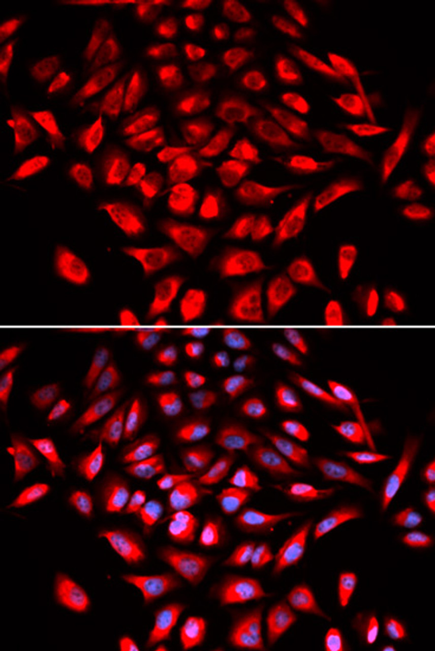 Immunofluorescence analysis of U2OS cells using CAMK4 antibody (19-573) . Blue: DAPI for nuclear staining.