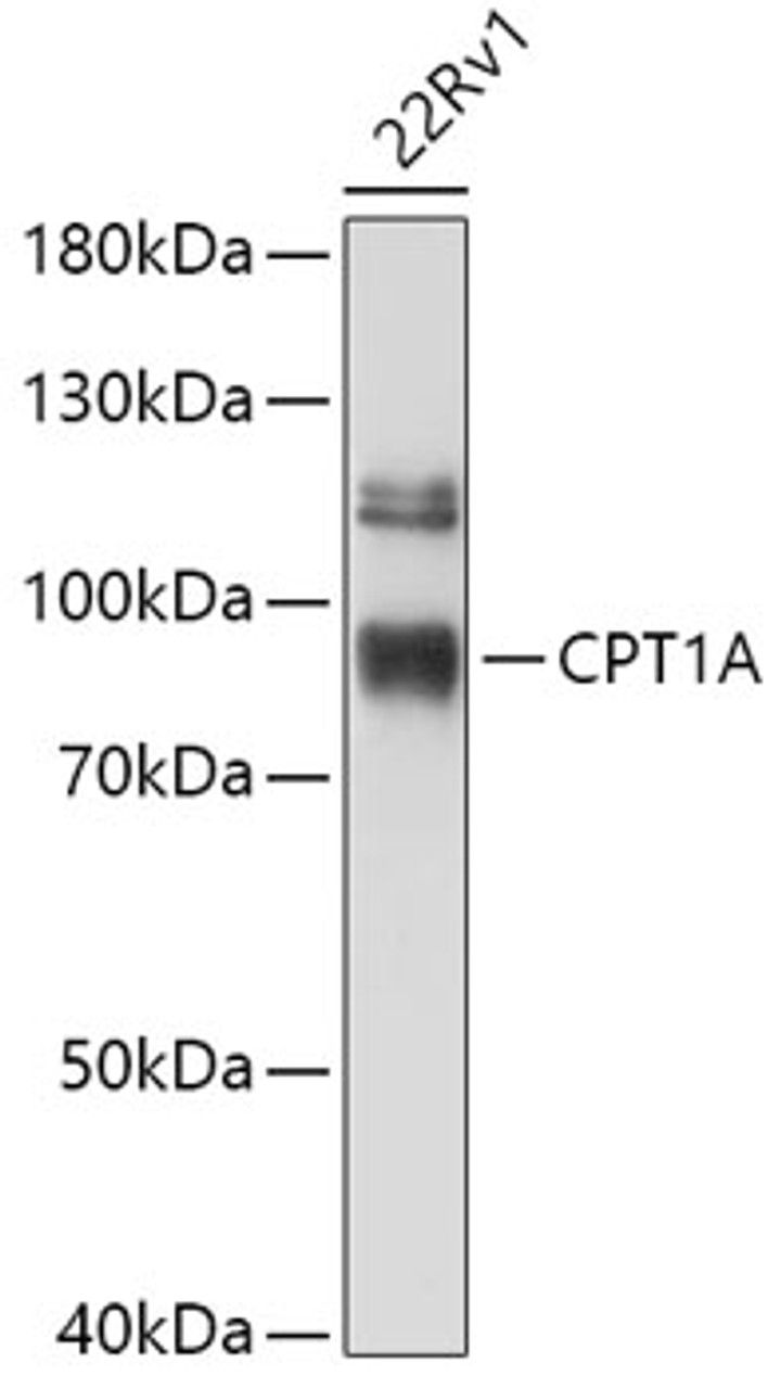 Western blot analysis of extracts of 22Rv1 cells, using CPT1A antibody (19-575) at 1:1000 dilution.<br/>Secondary antibody: HRP Goat Anti-Rabbit IgG (H+L) at 1:10000 dilution.<br/>Lysates/proteins: 25ug per lane.<br/>Blocking buffer: 3% nonfat dry milk in TBST.<br/>Detection: ECL Enhanced Kit.<br/>Exposure time: 5min.