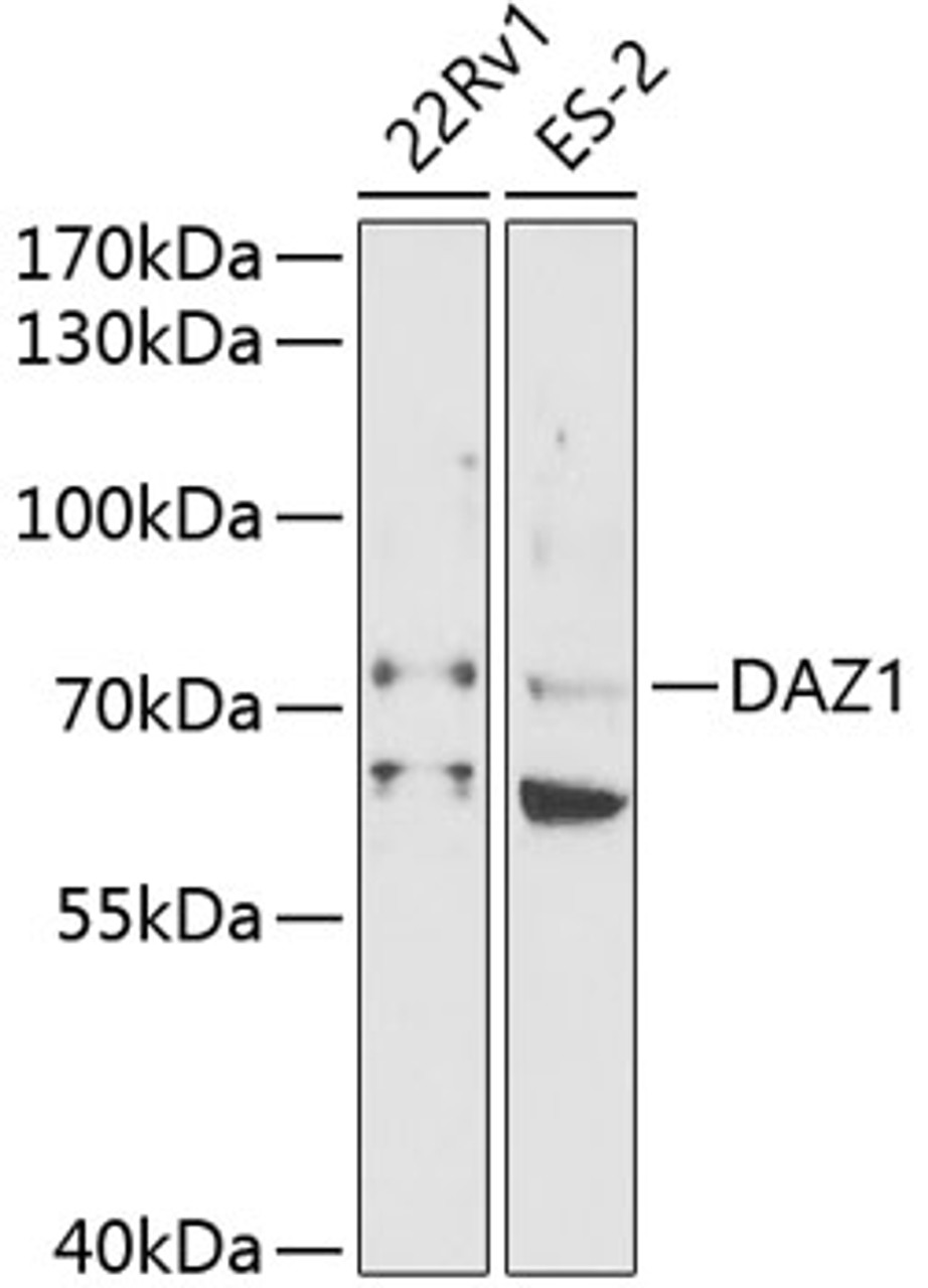 Western blot analysis of extracts of various cell lines, using DAZ1 antibody (19-578) at 1:1000 dilution.<br/>Secondary antibody: HRP Goat Anti-Rabbit IgG (H+L) at 1:10000 dilution.<br/>Lysates/proteins: 25ug per lane.<br/>Blocking buffer: 3% nonfat dry milk in TBST.<br/>Detection: ECL Basic Kit.<br/>Exposure time: 90s.