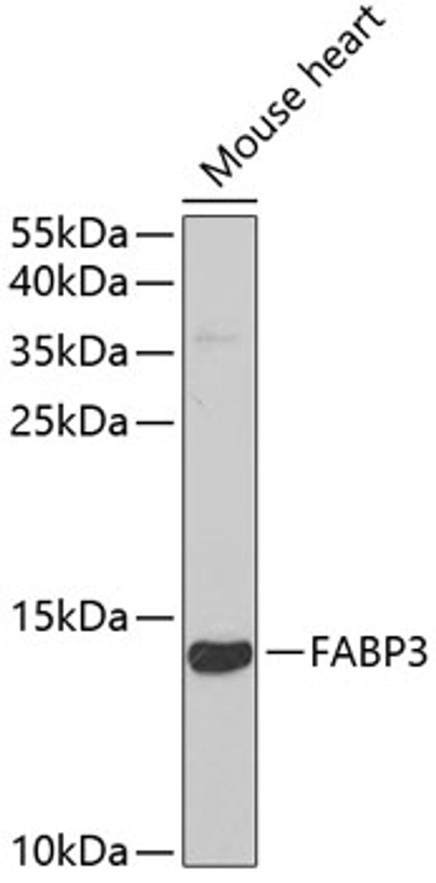 Western blot analysis of extracts of mouse heart, using FABP3 antibody (19-580) at 1:1000 dilution.<br/>Secondary antibody: HRP Goat Anti-Rabbit IgG (H+L) at 1:10000 dilution.<br/>Lysates/proteins: 25ug per lane.<br/>Blocking buffer: 3% nonfat dry milk in TBST.<br/>Detection: ECL Basic Kit.<br/>Exposure time: 90s.