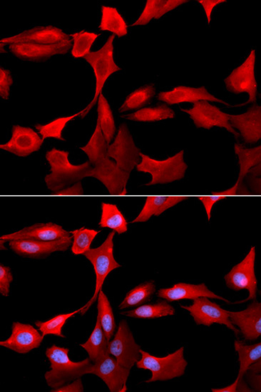 Immunofluorescence analysis of U2OS cells using GCLM antibody (19-581) . Blue: DAPI for nuclear staining.