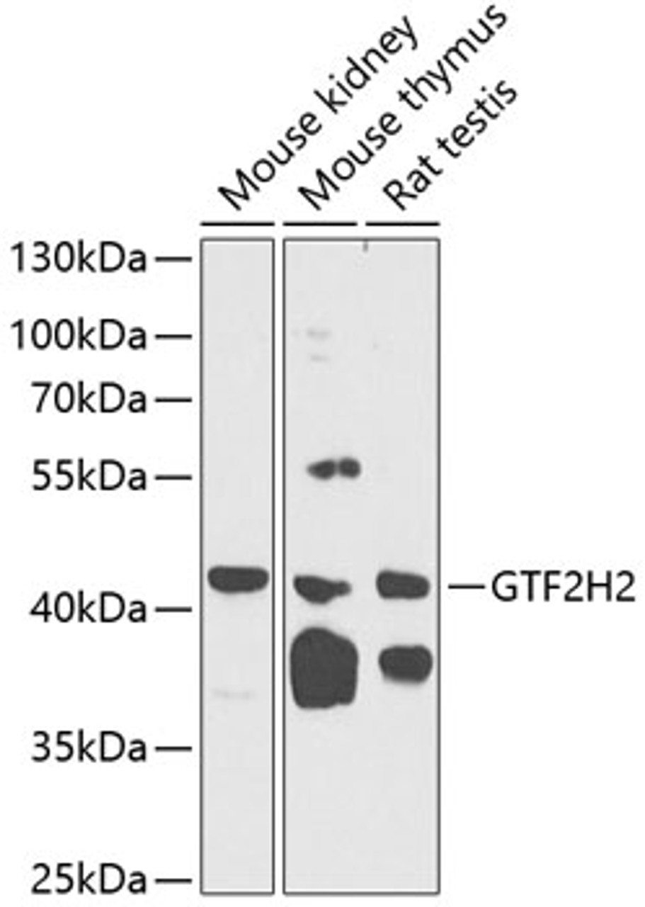 Western blot analysis of extracts of various cell lines, using GTF2H2 Antibody (19-583) at 1:1000 dilution.<br/>Secondary antibody: HRP Goat Anti-Rabbit IgG (H+L) at 1:10000 dilution.<br/>Lysates/proteins: 25ug per lane.<br/>Blocking buffer: 3% nonfat dry milk in TBST.<br/>Detection: ECL Basic Kit.<br/>Exposure time: 60s.