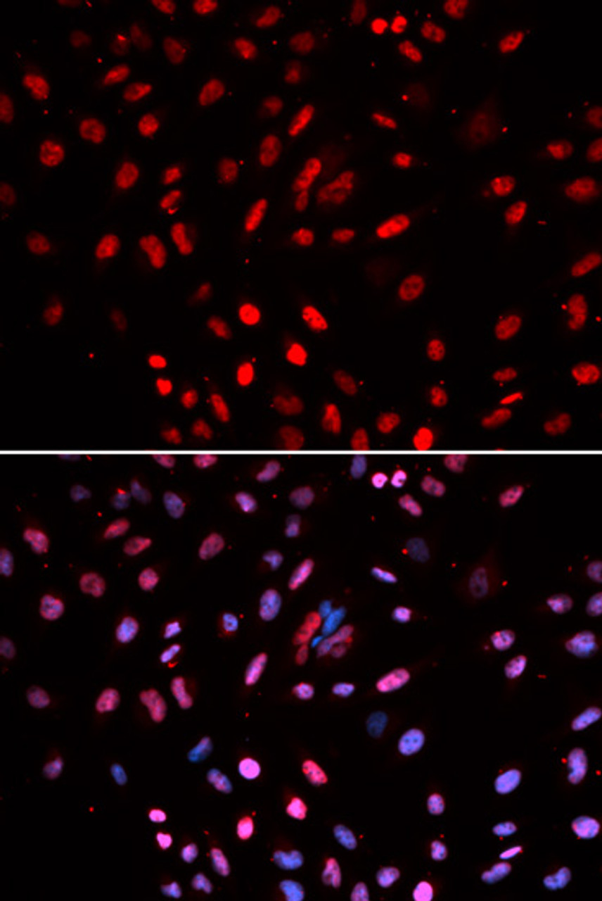 Immunofluorescence analysis of U2OS cells using POLD1 antibody (19-587) . Blue: DAPI for nuclear staining.