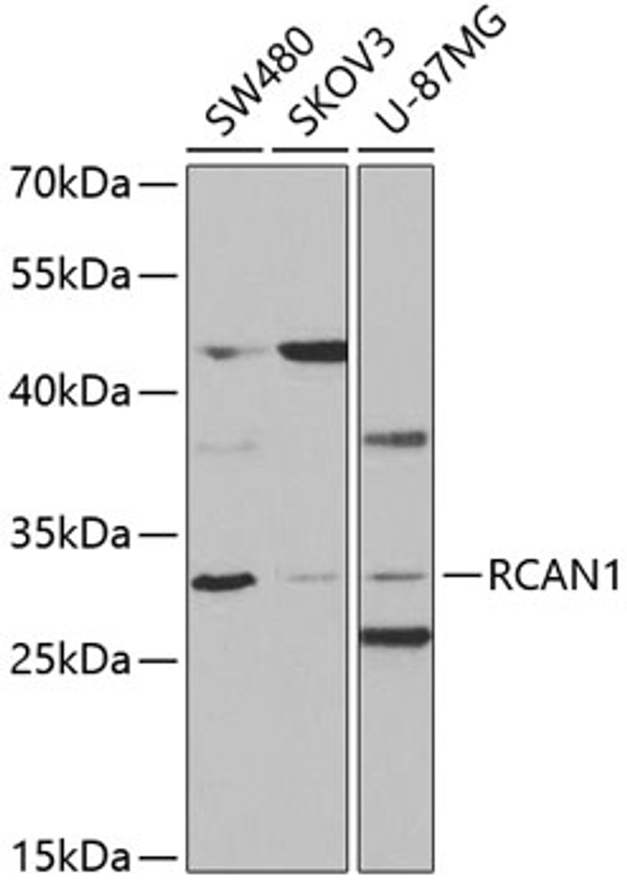Western blot analysis of extracts of various cell lines, using RCAN1 antibody (19-590) at 1:1000 dilution.<br/>Secondary antibody: HRP Goat Anti-Rabbit IgG (H+L) at 1:10000 dilution.<br/>Lysates/proteins: 25ug per lane.<br/>Blocking buffer: 3% nonfat dry milk in TBST.<br/>Detection: ECL Basic Kit.<br/>Exposure time: 90s.