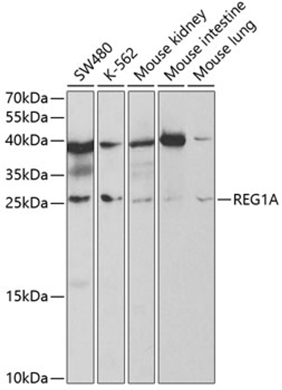 Western blot analysis of extracts of various cell lines, using REG1A antibody (19-591) at 1:1000 dilution._Secondary antibody: HRP Goat Anti-Rabbit IgG (H+L) at 1:10000 dilution._Lysates/proteins: 25ug per lane._Blocking buffer: 3% nonfat dry milk in TBST._Detection: ECL Basic Kit._Exposure time: 60s.