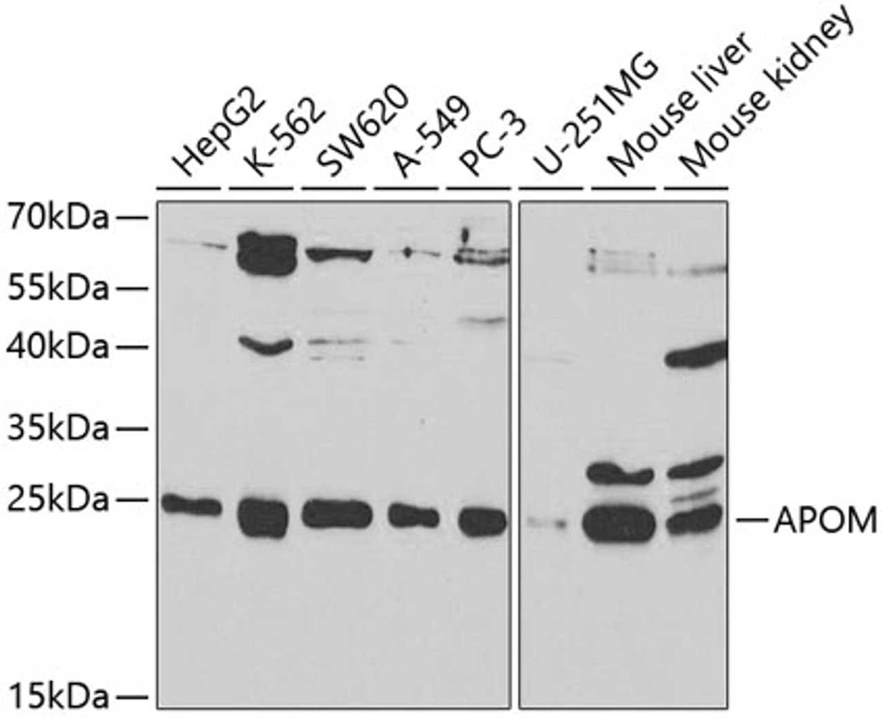 Western blot analysis of extracts of various cell lines, using APOM antibody (19-598) at 1:1000 dilution.<br/>Secondary antibody: HRP Goat Anti-Rabbit IgG (H+L) at 1:10000 dilution.<br/>Lysates/proteins: 25ug per lane.<br/>Blocking buffer: 3% nonfat dry milk in TBST.<br/>Detection: ECL Basic Kit.<br/>Exposure time: 90s.