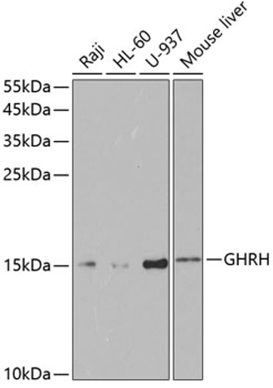 Western blot analysis of extracts of various cell lines, using GHRH antibody (19-603) at 1:1000 dilution.<br/>Secondary antibody: HRP Goat Anti-Rabbit IgG (H+L) at 1:10000 dilution.<br/>Lysates/proteins: 25ug per lane.<br/>Blocking buffer: 3% nonfat dry milk in TBST.<br/>Detection: ECL Basic Kit.<br/>Exposure time: 90s.