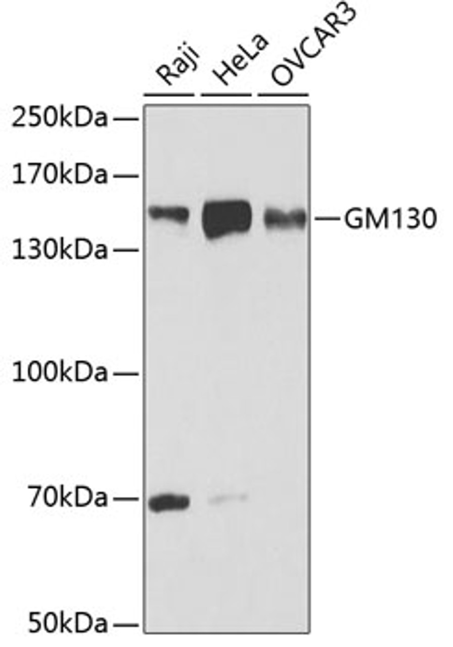 Western blot analysis of extracts of various cell lines, using GM130 antibody (19-604) at 1:1000 dilution.<br/>Secondary antibody: HRP Goat Anti-Rabbit IgG (H+L) at 1:10000 dilution.<br/>Lysates/proteins: 25ug per lane.<br/>Blocking buffer: 3% nonfat dry milk in TBST.<br/>Detection: ECL Basic Kit.<br/>Exposure time: 60s.