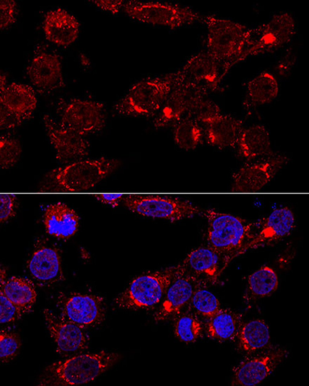 Immunofluorescence analysis of HeLa cells using GM130 antibody (19-604) at dilution of 1:400 (60x lens) . Blue: DAPI for nuclear staining.