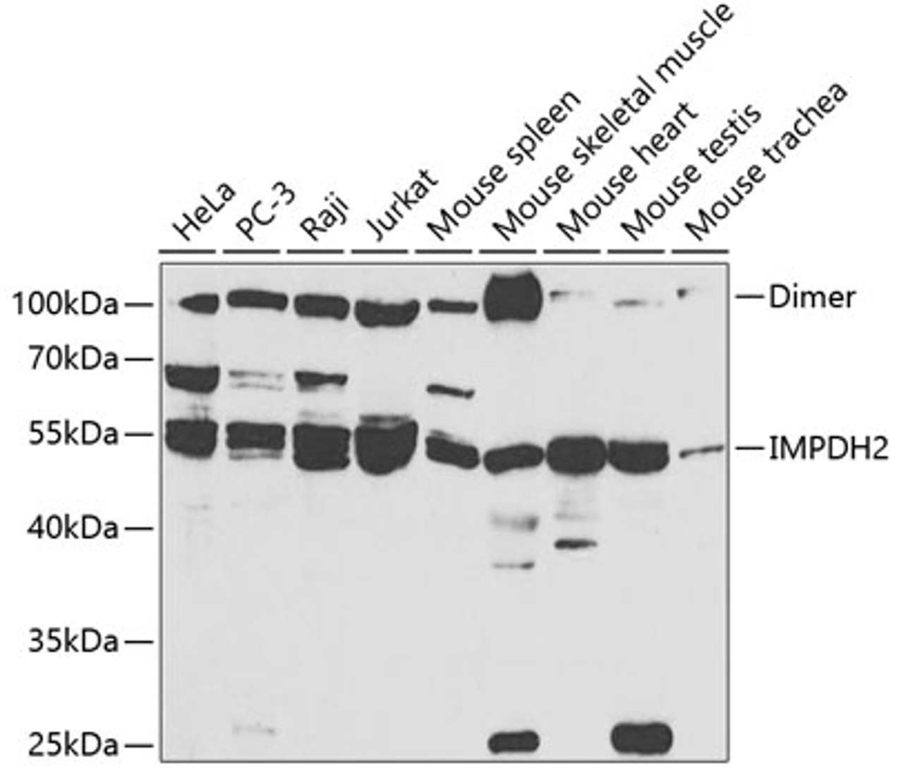 Western blot analysis of extracts of various cell lines, using IMPDH2 antibody (19-607) at 1:1000 dilution.<br/>Secondary antibody: HRP Goat Anti-Rabbit IgG (H+L) at 1:10000 dilution.<br/>Lysates/proteins: 25ug per lane.<br/>Blocking buffer: 3% nonfat dry milk in TBST.<br/>Detection: ECL Basic Kit.<br/>Exposure time: 20s.