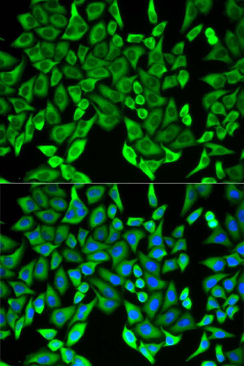 Immunofluorescence analysis of HeLa cells using MOG antibody (19-608) . Blue: DAPI for nuclear staining.