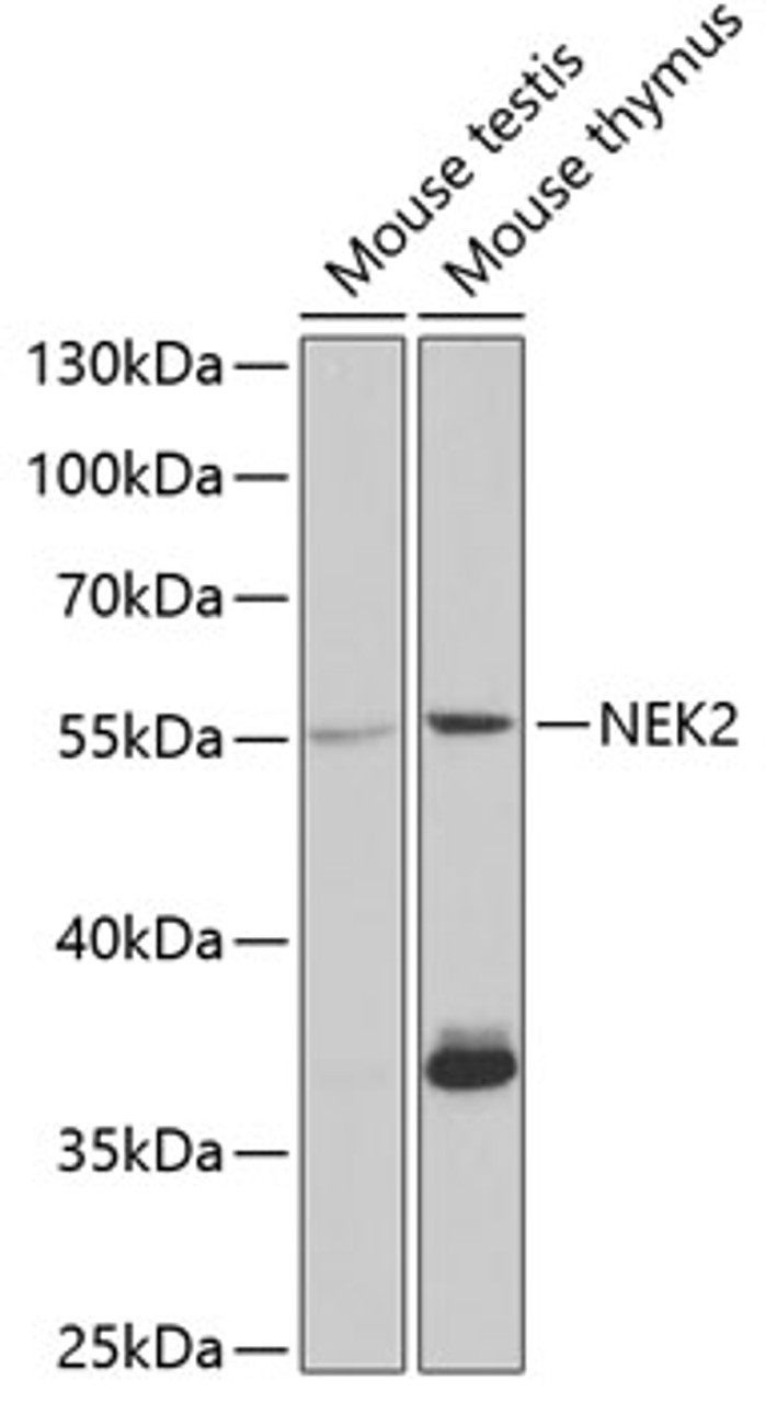 Western blot analysis of extracts of various cell lines, using NEK2 antibody (19-609) at 1:1000 dilution.<br/>Secondary antibody: HRP Goat Anti-Rabbit IgG (H+L) at 1:10000 dilution.<br/>Lysates/proteins: 25ug per lane.<br/>Blocking buffer: 3% nonfat dry milk in TBST.<br/>Detection: ECL Basic Kit.<br/>Exposure time: 10s.