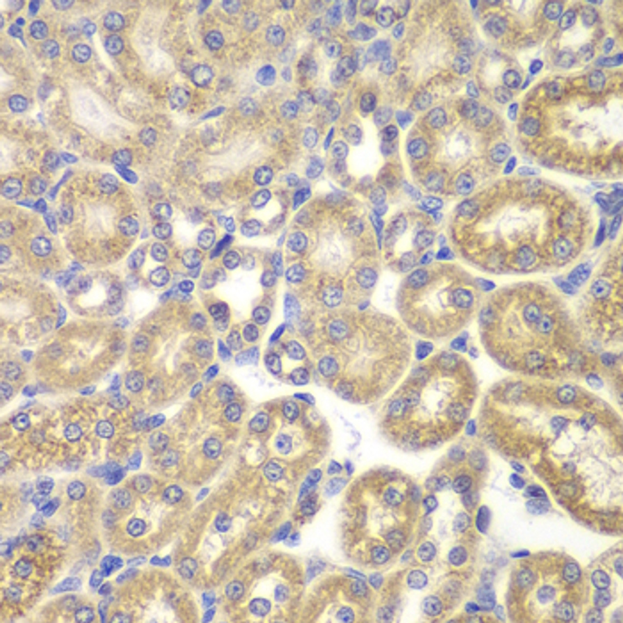 Immunohistochemistry of paraffin-embedded rat kidney using PSMD9 antibody (19-611) at dilution of 1:200 (40x lens) .