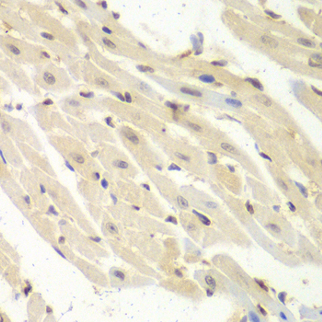 Immunohistochemistry of paraffin-embedded mouse heart using PSME1 antibody (19-612) at dilution of 1:100 (40x lens) .
