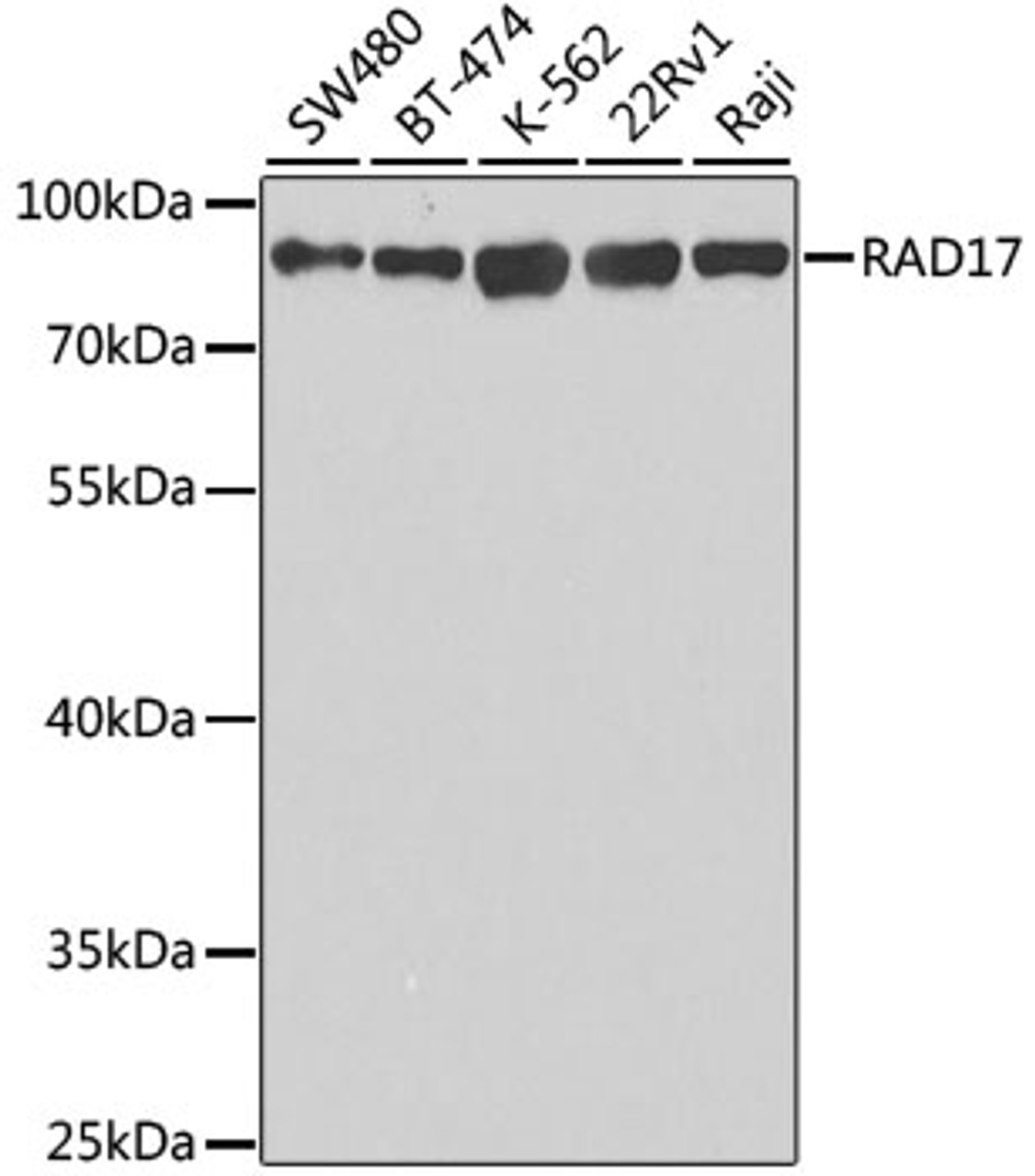 Western blot analysis of extracts of various cell lines, using RAD17 antibody (19-613) at 1:1000 dilution.<br/>Secondary antibody: HRP Goat Anti-Rabbit IgG (H+L) at 1:10000 dilution.<br/>Lysates/proteins: 25ug per lane.<br/>Blocking buffer: 3% nonfat dry milk in TBST.<br/>Detection: ECL Basic Kit.<br/>Exposure time: 3s.