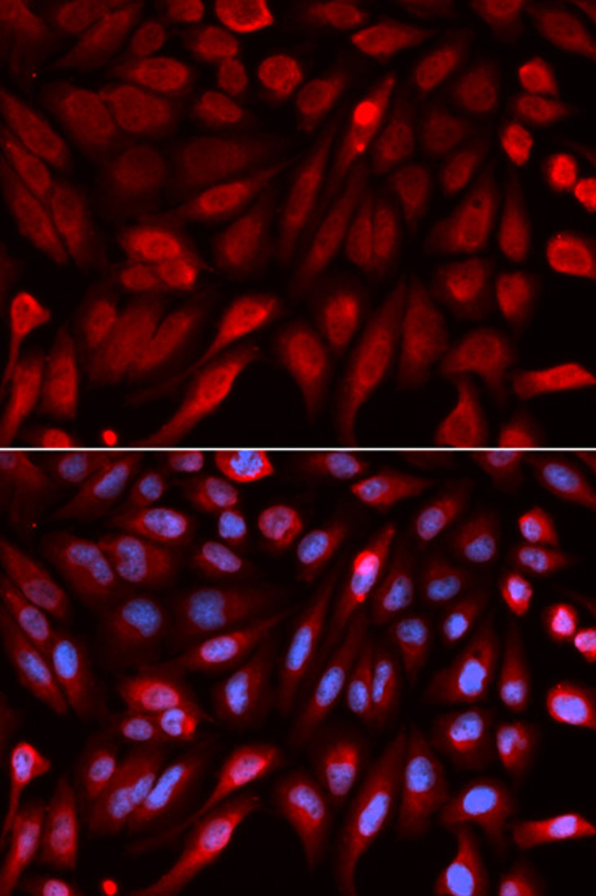 Immunofluorescence analysis of U2OS cells using SDCBP antibody (19-614) . Blue: DAPI for nuclear staining.