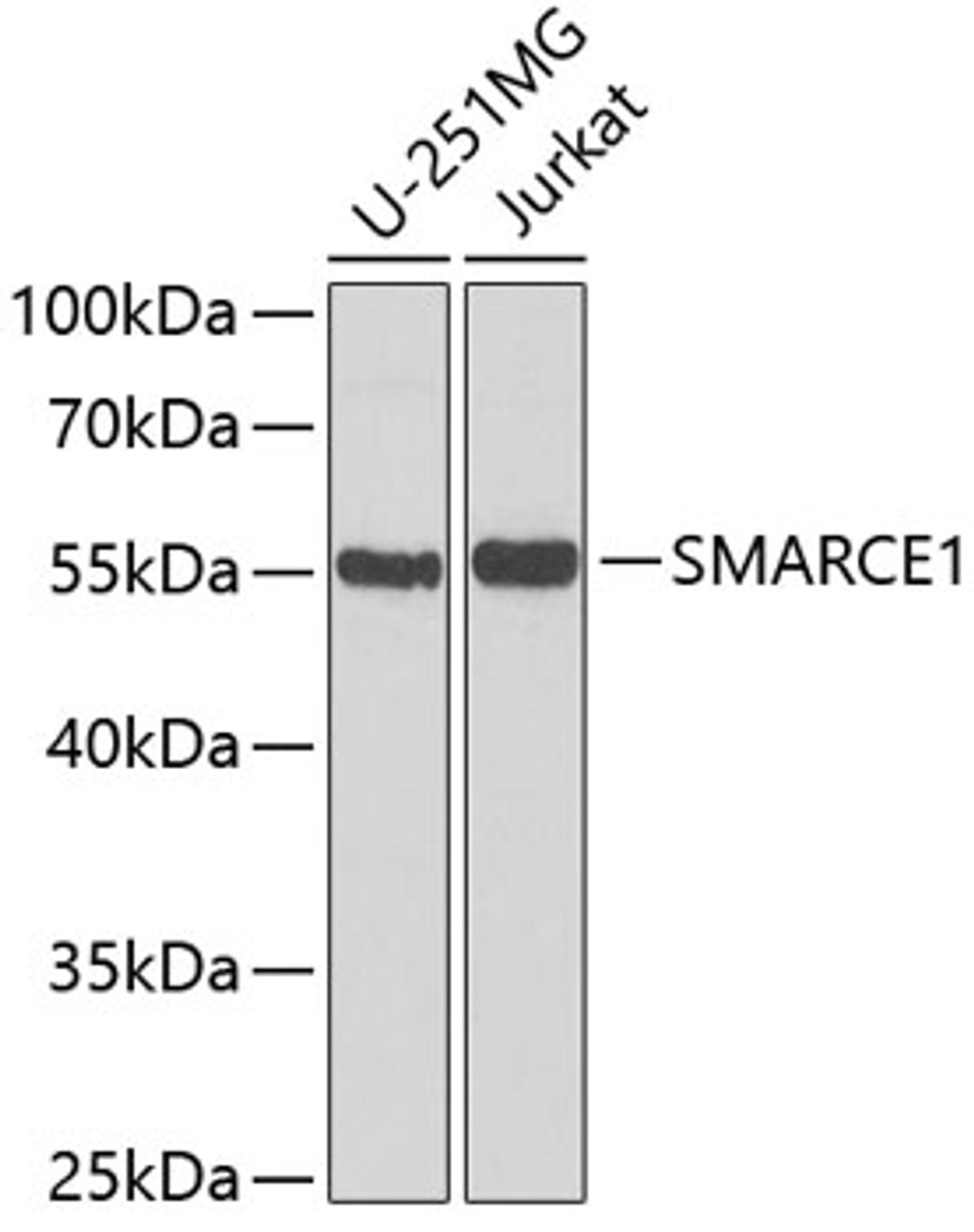 Western blot analysis of extracts of various cell lines, using SMARCE1 antibody (19-615) at 1:1000 dilution.<br/>Secondary antibody: HRP Goat Anti-Rabbit IgG (H+L) at 1:10000 dilution.<br/>Lysates/proteins: 25ug per lane.<br/>Blocking buffer: 3% nonfat dry milk in TBST.<br/>Detection: ECL Basic Kit.<br/>Exposure time: 90s.