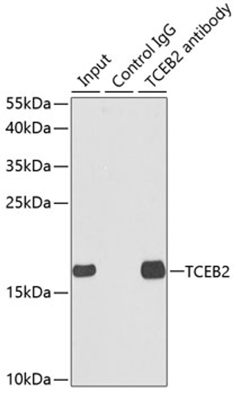 Immunoprecipitation analysis of 150ug extracts of MCF7 cells using 3ug TCEB2 antibody (19-616) . Western blot was performed from the immunoprecipitate using TCEB2 antibody (19-616) at a dilition of 1:500.