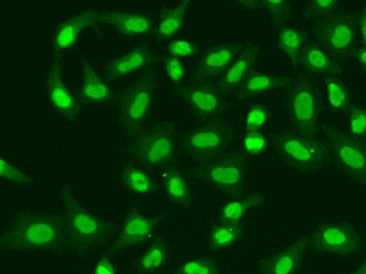 Immunofluorescence analysis of A549 cells using APTX antibody (19-618) .