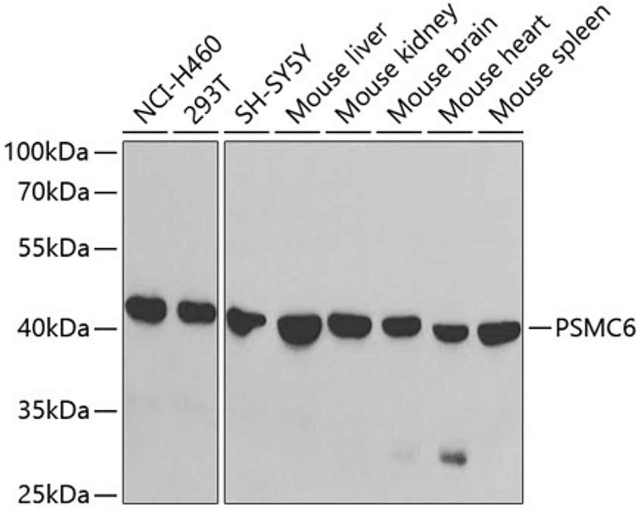 Western blot analysis of extracts of various cell lines, using PSMC6 antibody (19-626) at 1:1000 dilution.<br/>Secondary antibody: HRP Goat Anti-Rabbit IgG (H+L) at 1:10000 dilution.<br/>Lysates/proteins: 25ug per lane.<br/>Blocking buffer: 3% nonfat dry milk in TBST.<br/>Detection: ECL Basic Kit.<br/>Exposure time: 90s.