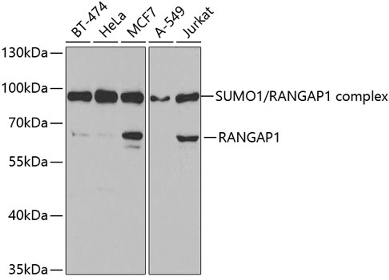 Western blot analysis of extracts of various cell lines, using RANGAP1 antibody (19-628) at 1:1000 dilution.<br/>Secondary antibody: HRP Goat Anti-Rabbit IgG (H+L) at 1:10000 dilution.<br/>Lysates/proteins: 25ug per lane.<br/>Blocking buffer: 3% nonfat dry milk in TBST.<br/>Detection: ECL Basic Kit.<br/>Exposure time: 90s.