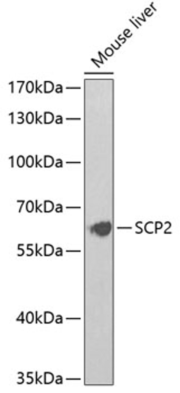 Western blot analysis of extracts of mouse liver, using SCP2 Antibody (19-629) at 1:1000 dilution.<br/>Secondary antibody: HRP Goat Anti-Rabbit IgG (H+L) at 1:10000 dilution.<br/>Lysates/proteins: 25ug per lane.<br/>Blocking buffer: 3% nonfat dry milk in TBST.<br/>Detection: ECL Basic Kit.<br/>Exposure time: 90s.