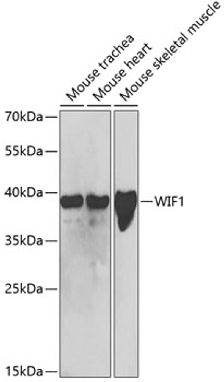 Western blot analysis of extracts of various cell lines, using WIF1 antibody (19-631) at 1:1000 dilution.<br/>Secondary antibody: HRP Goat Anti-Rabbit IgG (H+L) at 1:10000 dilution.<br/>Lysates/proteins: 25ug per lane.<br/>Blocking buffer: 3% nonfat dry milk in TBST.<br/>Detection: ECL Basic Kit.<br/>Exposure time: 90s.
