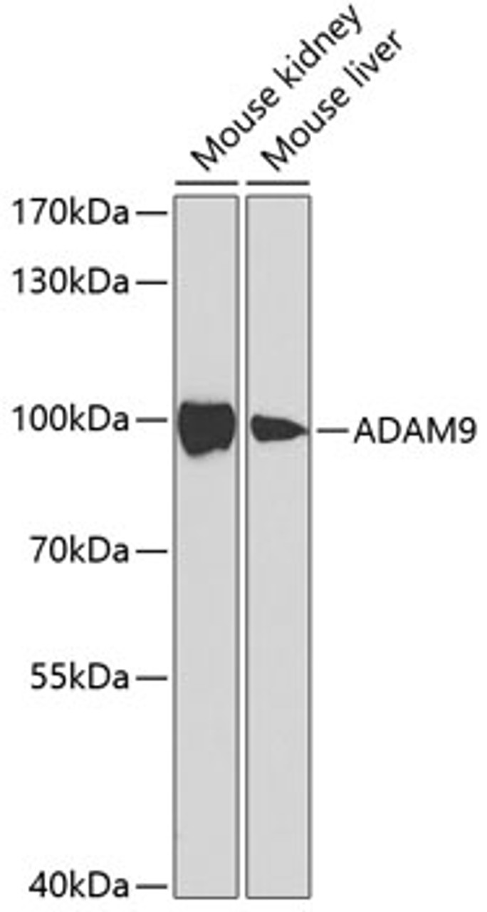 Western blot analysis of extracts of various cell lines, using ADAM9 antibody (19-633) at 1:1000 dilution.<br/>Secondary antibody: HRP Goat Anti-Rabbit IgG (H+L) at 1:10000 dilution.<br/>Lysates/proteins: 25ug per lane.<br/>Blocking buffer: 3% nonfat dry milk in TBST.<br/>Detection: ECL Basic Kit.<br/>Exposure time: 30s.