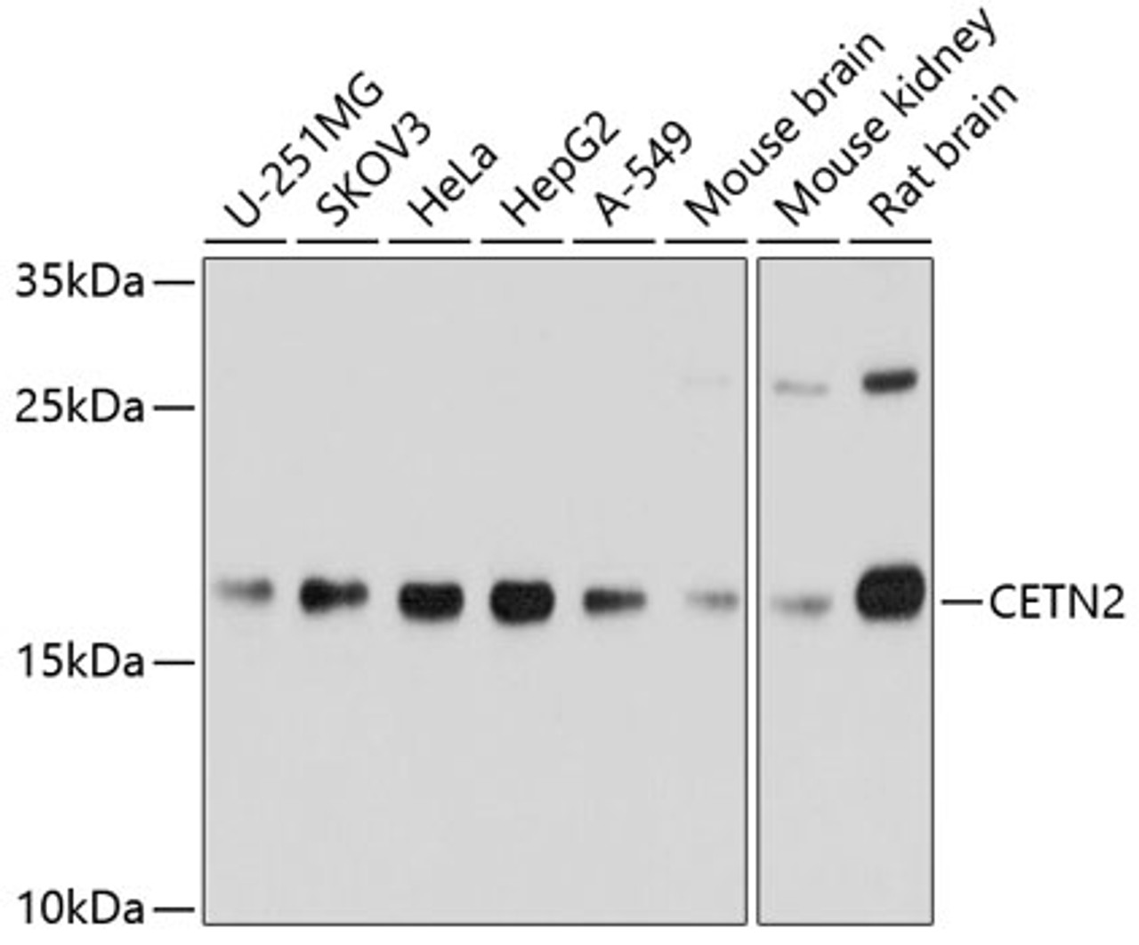 Western blot analysis of extracts of various cell lines, using CETN2 Antibody (19-637) at 1:1000 dilution.<br/>Secondary antibody: HRP Goat Anti-Rabbit IgG (H+L) at 1:10000 dilution.<br/>Lysates/proteins: 25ug per lane.<br/>Blocking buffer: 3% nonfat dry milk in TBST.<br/>Detection: ECL Basic Kit.<br/>Exposure time: 5s.