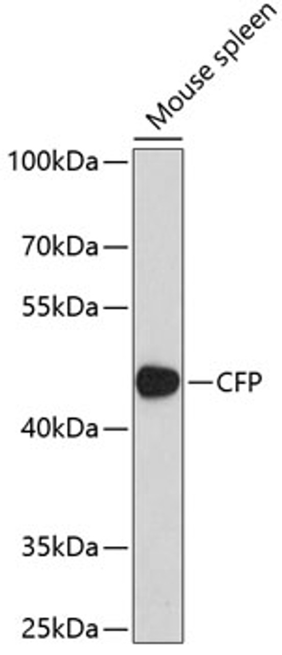 Western blot analysis of extracts of mouse spleen, using CFP antibody (19-638) at 1:1000 dilution.<br/>Secondary antibody: HRP Goat Anti-Rabbit IgG (H+L) at 1:10000 dilution.<br/>Lysates/proteins: 25ug per lane.<br/>Blocking buffer: 3% nonfat dry milk in TBST.<br/>Detection: ECL Basic Kit.<br/>Exposure time: 90s.