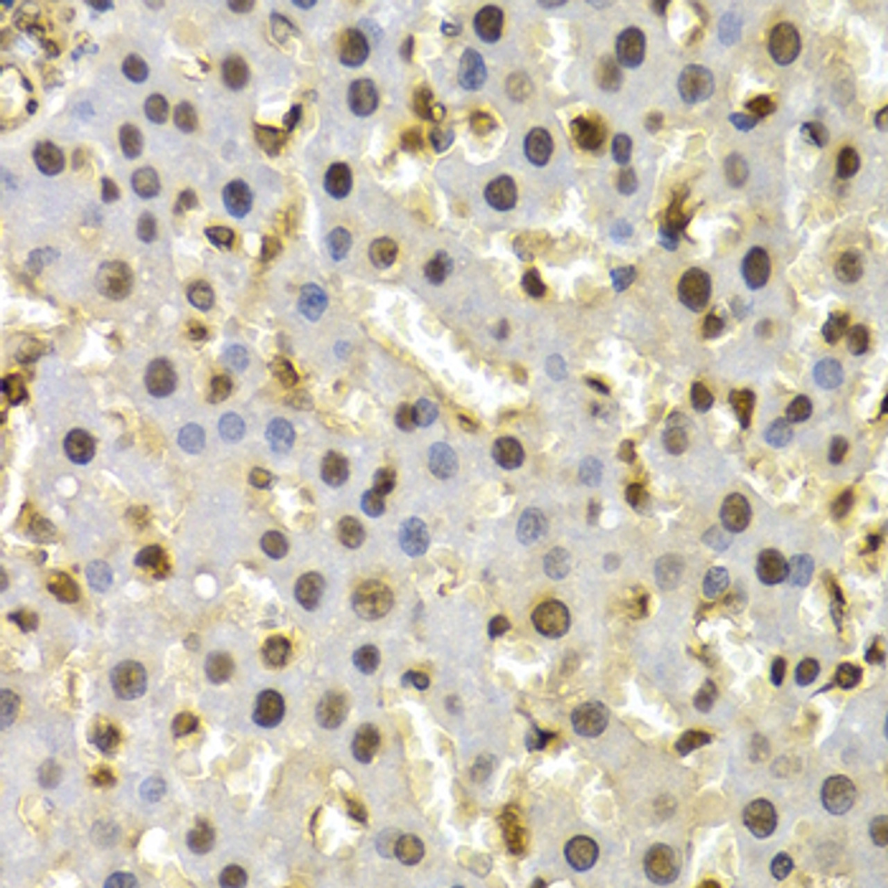 Immunohistochemistry of paraffin-embedded rat liver using CUL4B antibody (19-640) at dilution of 1:200 (40x lens) .