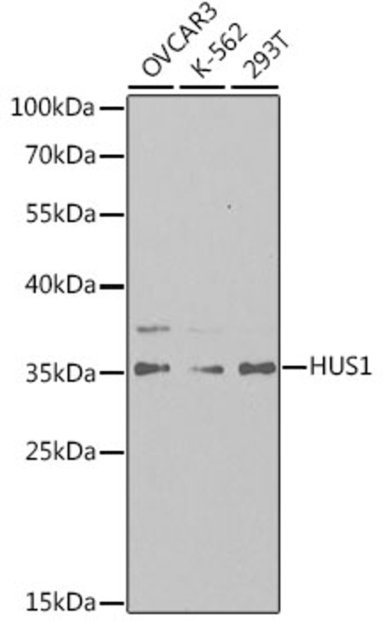 Western blot analysis of extracts of various cell lines, using HUS1 antibody (19-646) at 1:1000 dilution.<br/>Secondary antibody: HRP Goat Anti-Rabbit IgG (H+L) at 1:10000 dilution.<br/>Lysates/proteins: 25ug per lane.<br/>Blocking buffer: 3% nonfat dry milk in TBST.<br/>Detection: ECL Basic Kit.<br/>Exposure time: 180s.