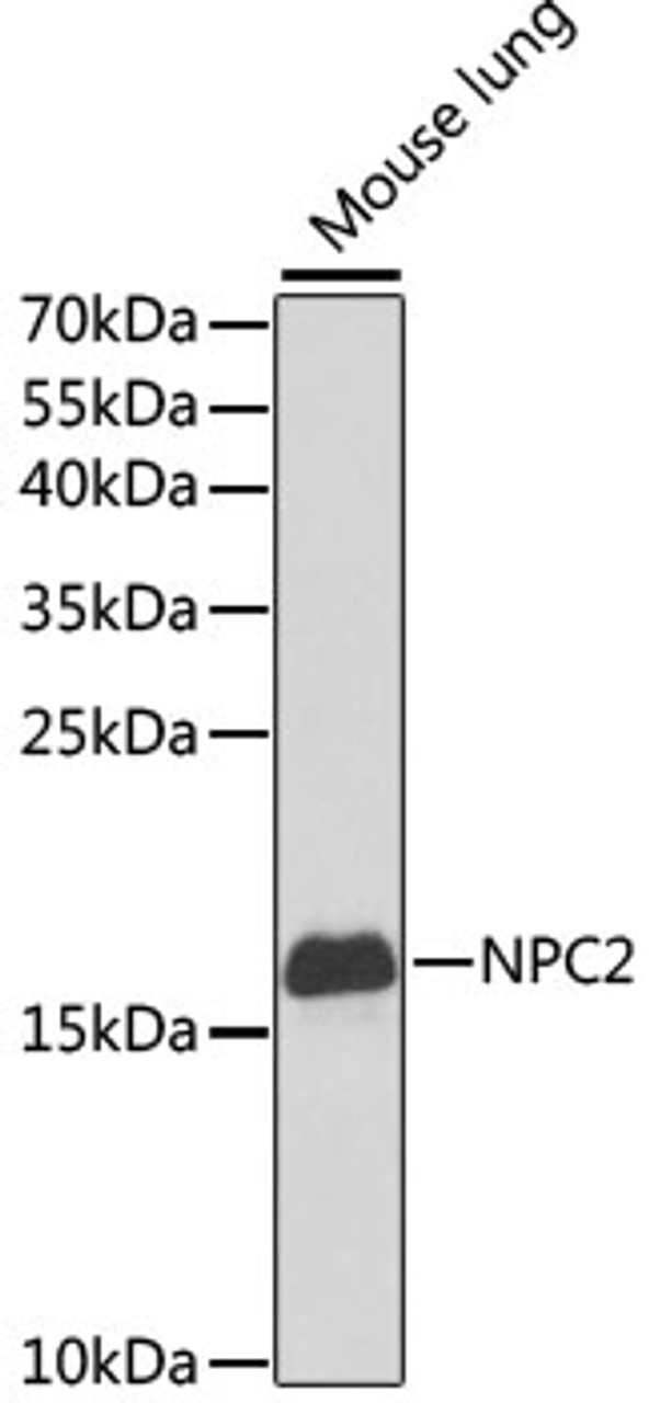 Western blot analysis of extracts of mouse lung, using NPC2 antibody (19-648) at 1:1000 dilution.<br/>Secondary antibody: HRP Goat Anti-Rabbit IgG (H+L) at 1:10000 dilution.<br/>Lysates/proteins: 25ug per lane.<br/>Blocking buffer: 3% nonfat dry milk in TBST.<br/>Detection: ECL Basic Kit.<br/>Exposure time: 90s.