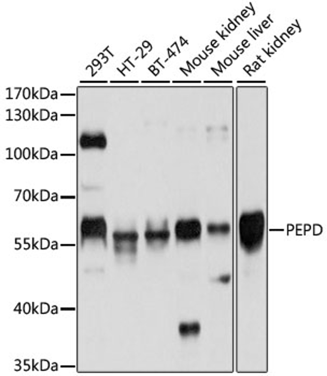 Western blot analysis of extracts of various cell lines, using PEPD antibody (19-649) at 1:1000 dilution.<br/>Secondary antibody: HRP Goat Anti-Rabbit IgG (H+L) at 1:10000 dilution.<br/>Lysates/proteins: 25ug per lane.<br/>Blocking buffer: 3% nonfat dry milk in TBST.<br/>Detection: ECL Basic Kit.<br/>Exposure time: 3s.