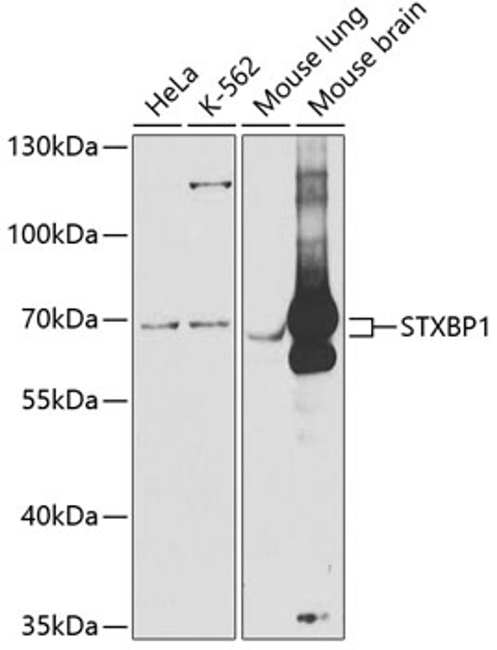 Western blot analysis of extracts of various cell lines, using STXBP1 antibody (19-651) at 1:1000 dilution.<br/>Secondary antibody: HRP Goat Anti-Rabbit IgG (H+L) at 1:10000 dilution.<br/>Lysates/proteins: 25ug per lane.<br/>Blocking buffer: 3% nonfat dry milk in TBST.<br/>Detection: ECL Basic Kit.<br/>Exposure time: 60s.