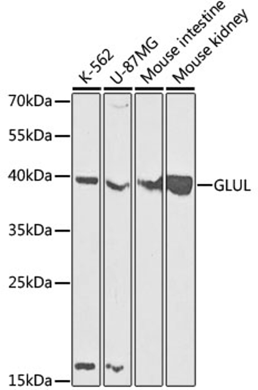 Western blot analysis of extracts of various cell lines, using GLUL antibody (19-660) at 1:1000 dilution.<br/>Secondary antibody: HRP Goat Anti-Rabbit IgG (H+L) at 1:10000 dilution.<br/>Lysates/proteins: 25ug per lane.<br/>Blocking buffer: 3% nonfat dry milk in TBST.<br/>Detection: ECL Basic Kit.<br/>Exposure time: 90s.