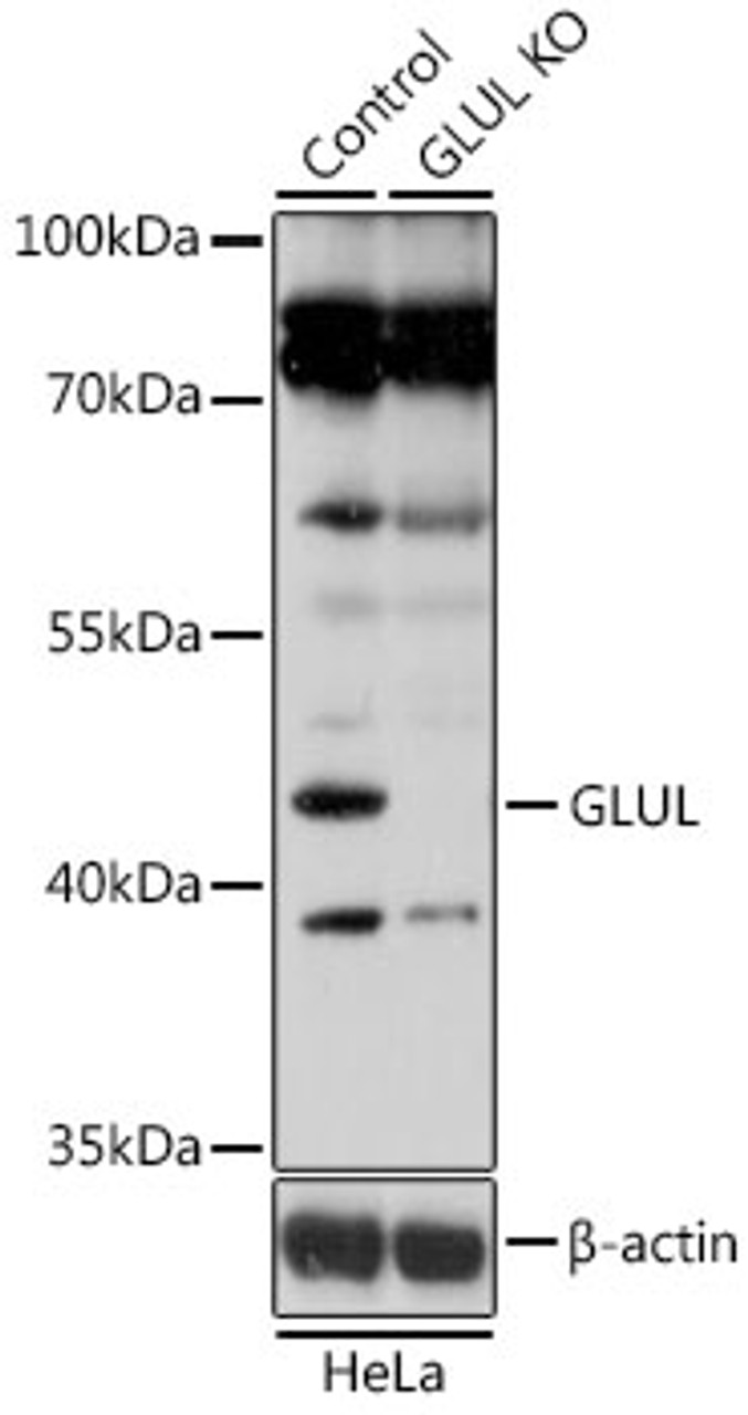 Western blot analysis of extracts from normal (control) and GLUL knockout (KO) HeLa cells, using GLUL antibody (19-660) at 1:1000 dilution.<br/>Secondary antibody: HRP Goat Anti-Rabbit IgG (H+L) at 1:10000 dilution.<br/>Lysates/proteins: 25ug per lane.<br/>Blocking buffer: 3% nonfat dry milk in TBST.<br/>Detection: ECL Basic Kit.<br/>Exposure time: 3s.