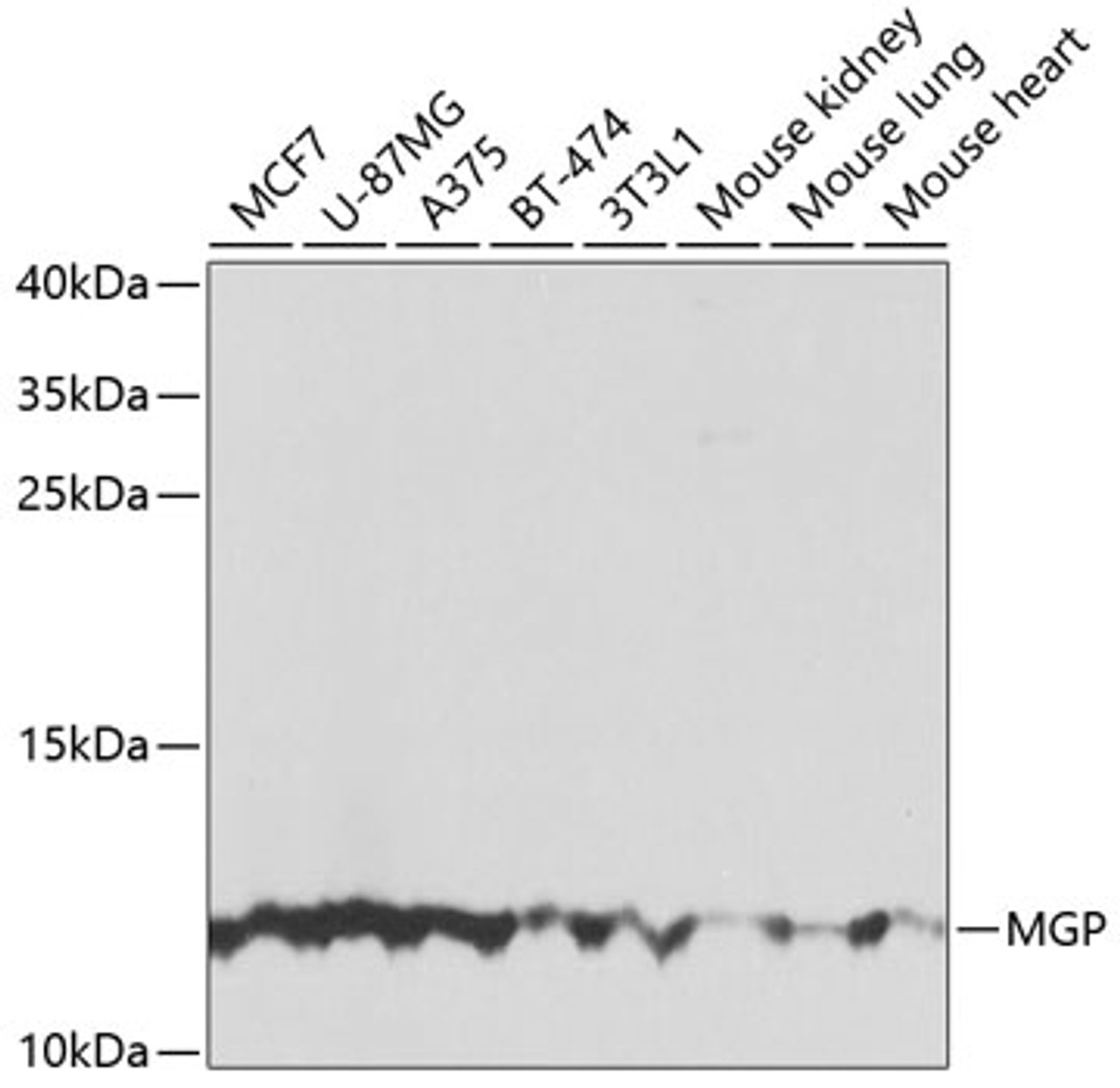 Western blot analysis of extracts of various cell lines, using MGP antibody (19-662) at 1:1000 dilution.<br/>Secondary antibody: HRP Goat Anti-Rabbit IgG (H+L) at 1:10000 dilution.<br/>Lysates/proteins: 25ug per lane.<br/>Blocking buffer: 3% nonfat dry milk in TBST.<br/>Detection: ECL Basic Kit.<br/>Exposure time: 120s.