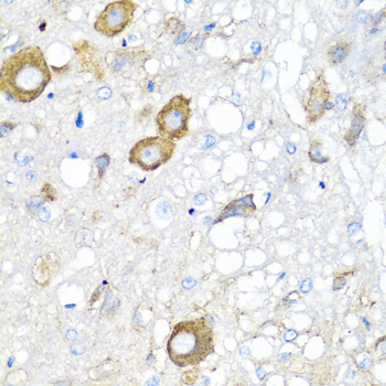 Immunohistochemistry of paraffin-embedded rat brain using MGP antibody (19-662) at dilution of 1:100 (40x lens) .