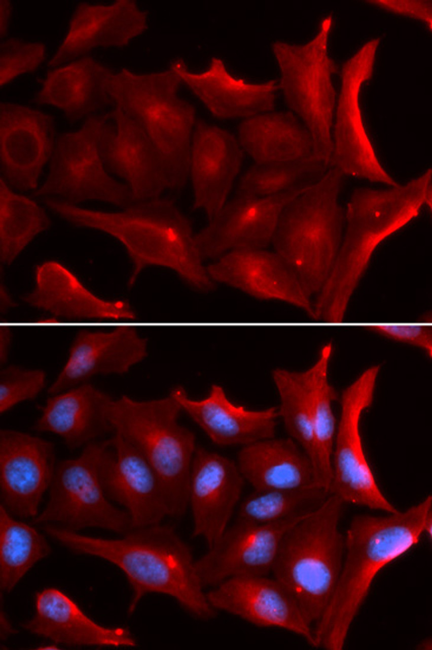 Immunofluorescence analysis of U2OS cells using NQO2 antibody (19-663) . Blue: DAPI for nuclear staining.