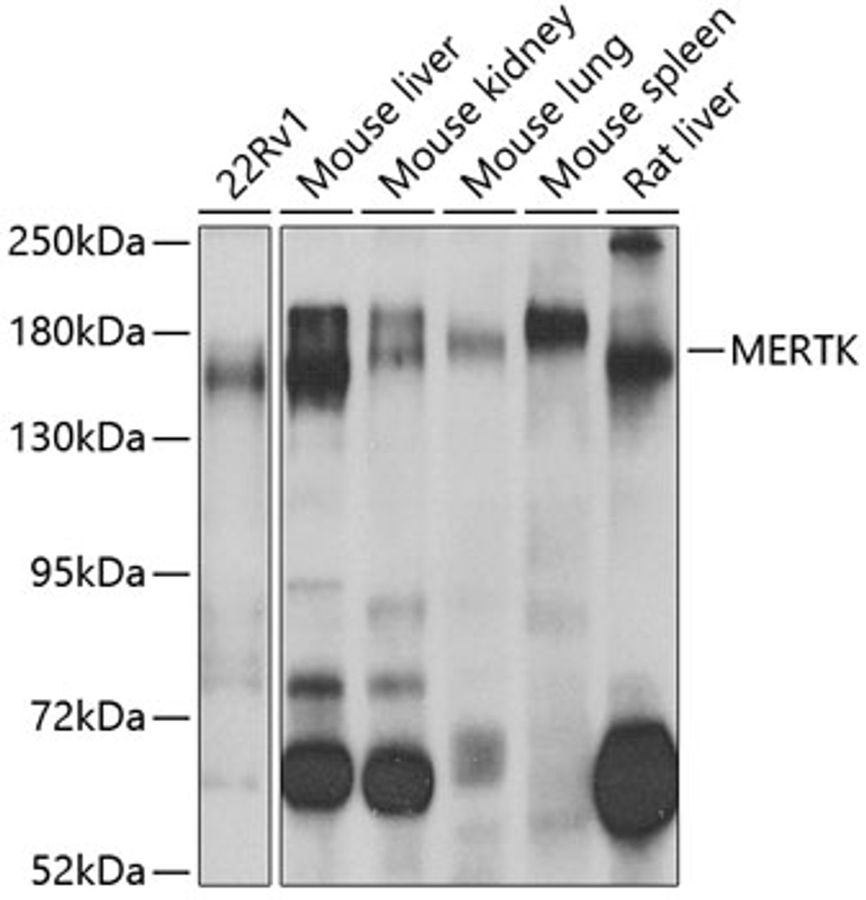 Western blot analysis of extracts of various cell lines, using MERTK antibody (19-665) at 1:1000 dilution._Secondary antibody: HRP Goat Anti-Rabbit IgG (H+L) at 1:10000 dilution._Lysates/proteins: 25ug per lane._Blocking buffer: 3% nonfat dry milk in TBST._Detection: ECL Enhanced Kit._Exposure time: 60s.