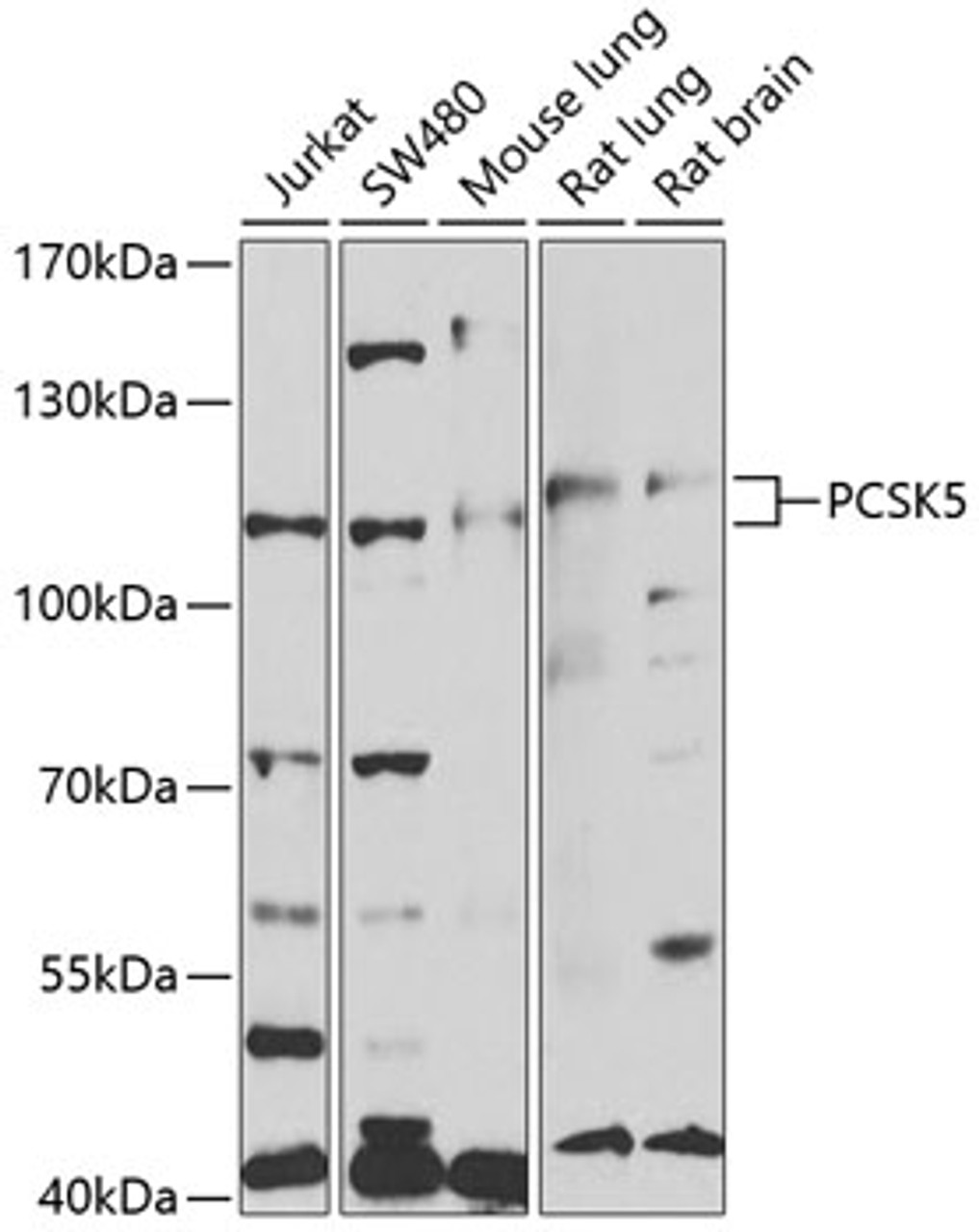 Western blot analysis of extracts of various cell lines, using PCSK5 antibody (19-671) at 1:1000 dilution._Secondary antibody: HRP Goat Anti-Rabbit IgG (H+L) at 1:10000 dilution._Lysates/proteins: 25ug per lane._Blocking buffer: 3% nonfat dry milk in TBST._Detection: ECL Enhanced Kit._Exposure time: 90s.