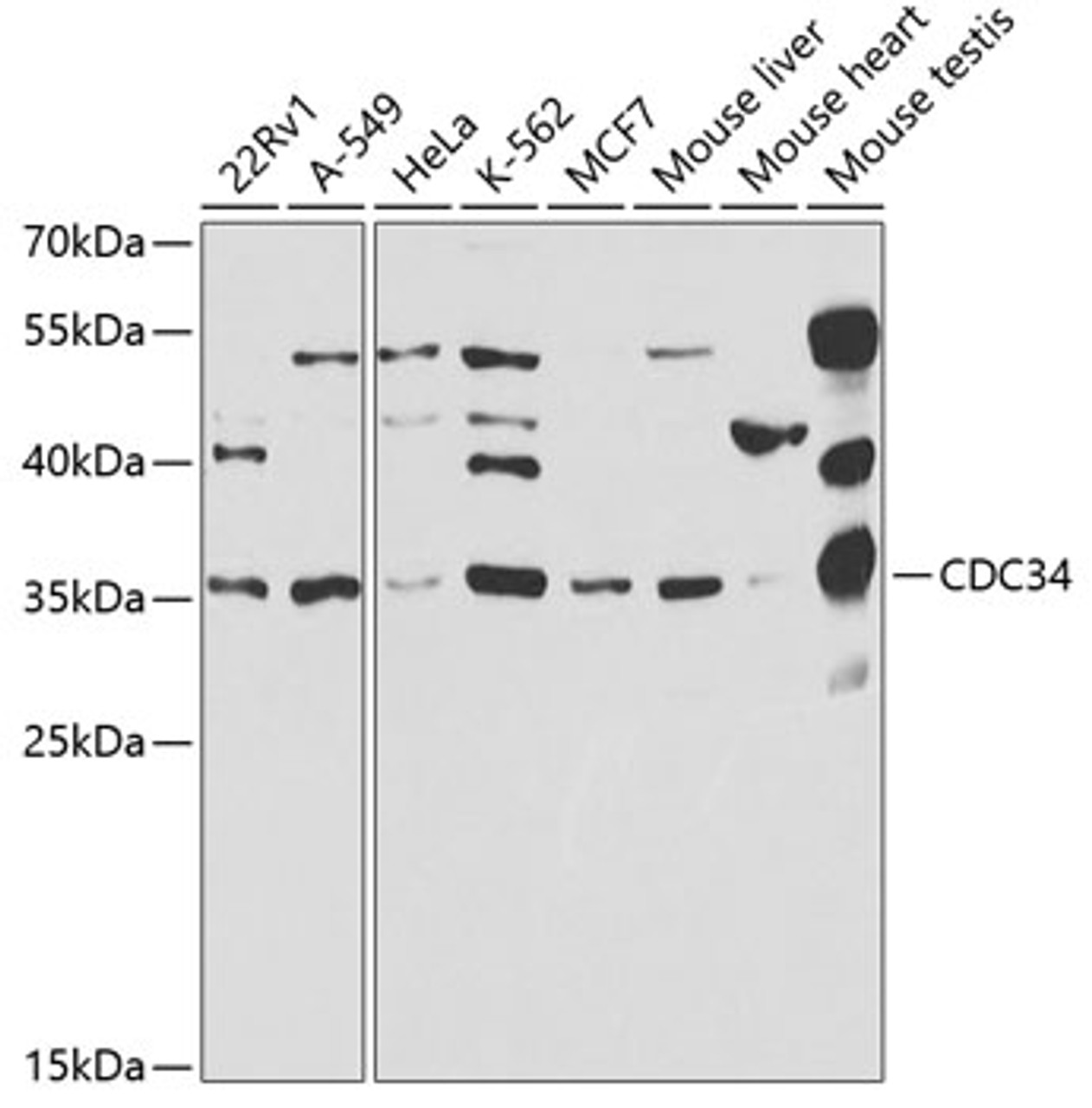 Western blot analysis of extracts of various cell lines, using CDC34 antibody (19-676) at 1:1000 dilution.<br/>Secondary antibody: HRP Goat Anti-Rabbit IgG (H+L) at 1:10000 dilution.<br/>Lysates/proteins: 25ug per lane.<br/>Blocking buffer: 3% nonfat dry milk in TBST.<br/>Detection: ECL Basic Kit.<br/>Exposure time: 60s.