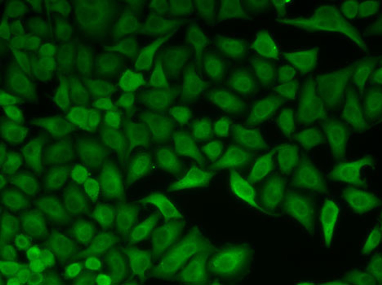 Immunofluorescence analysis of HeLa cells using CDC34 antibody (19-676) .