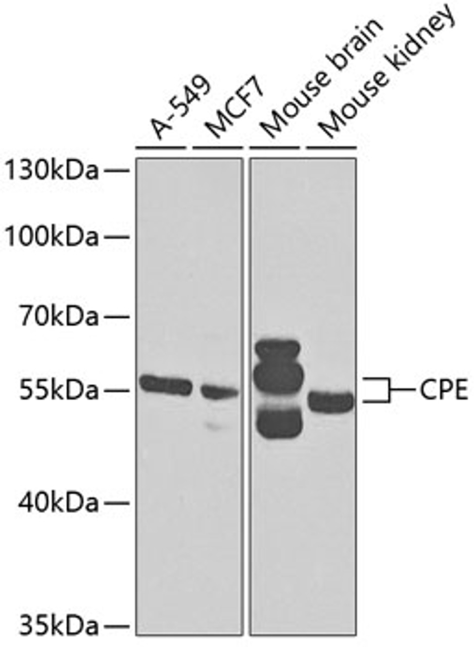 Western blot analysis of extracts of various cell lines, using CPE antibody (19-677) at 1:1000 dilution.<br/>Secondary antibody: HRP Goat Anti-Rabbit IgG (H+L) at 1:10000 dilution.<br/>Lysates/proteins: 25ug per lane.<br/>Blocking buffer: 3% nonfat dry milk in TBST.<br/>Detection: ECL Basic Kit.<br/>Exposure time: 30s.