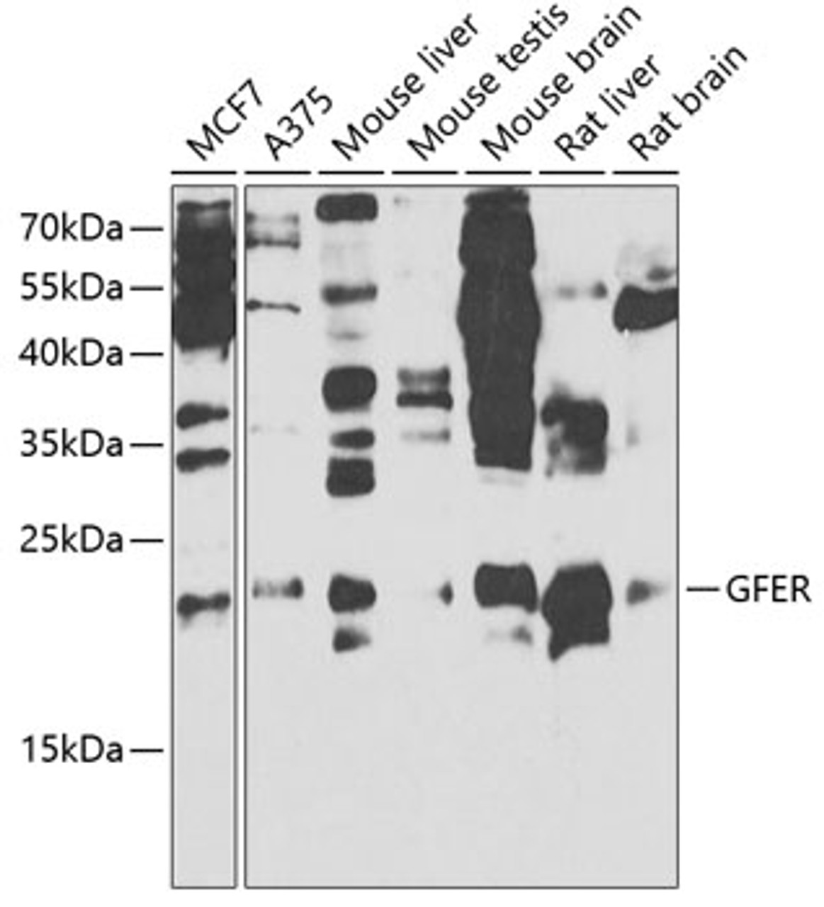 Western blot analysis of extracts of various cell lines, using GFER antibody (19-680) at 1:1000 dilution._Secondary antibody: HRP Goat Anti-Rabbit IgG (H+L) at 1:10000 dilution._Lysates/proteins: 25ug per lane._Blocking buffer: 3% nonfat dry milk in TBST._Detection: ECL Enhanced Kit._Exposure time: 90s.