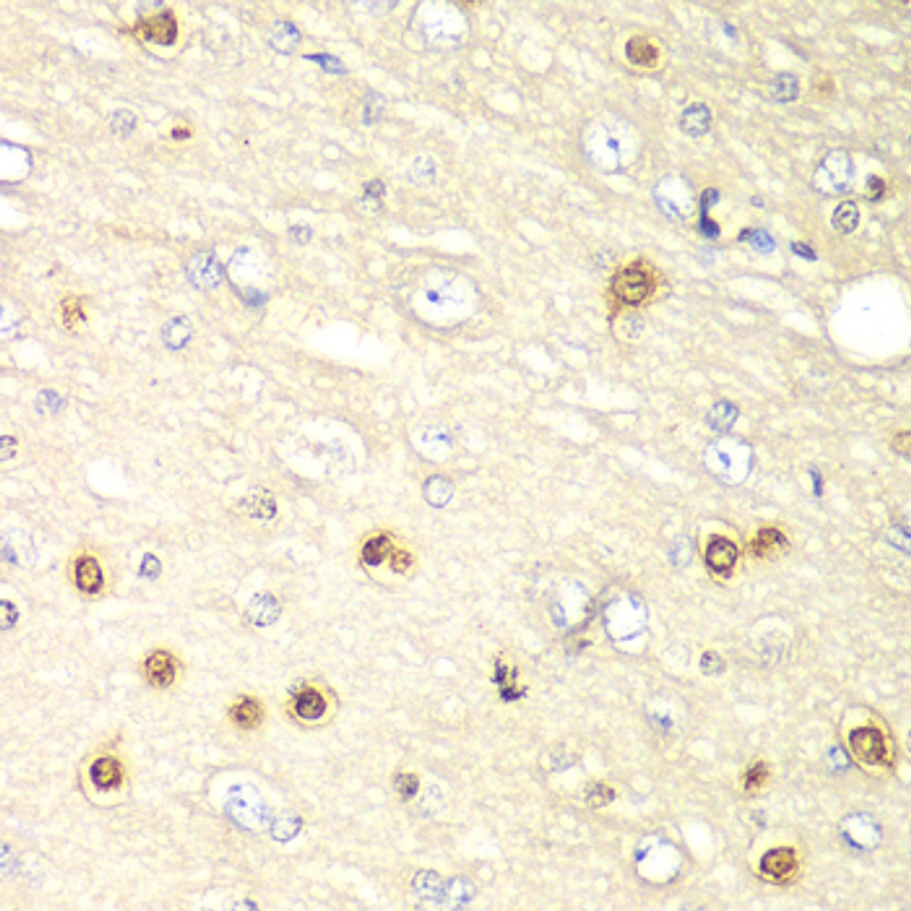 Immunohistochemistry of paraffin-embedded rat brain using HIF1AN antibody (19-681) at dilution of 1:100 (40x lens) .