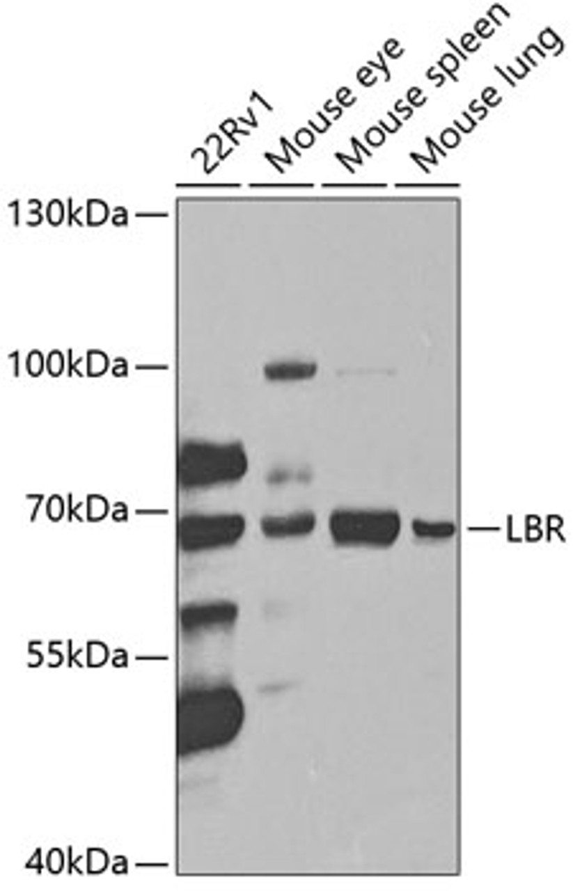 Western blot analysis of extracts of various cell lines, using LBR antibody (19-682) at 1:1000 dilution._Secondary antibody: HRP Goat Anti-Rabbit IgG (H+L) at 1:10000 dilution._Lysates/proteins: 25ug per lane._Blocking buffer: 3% nonfat dry milk in TBST._Detection: ECL Enhanced Kit._Exposure time: 90s.