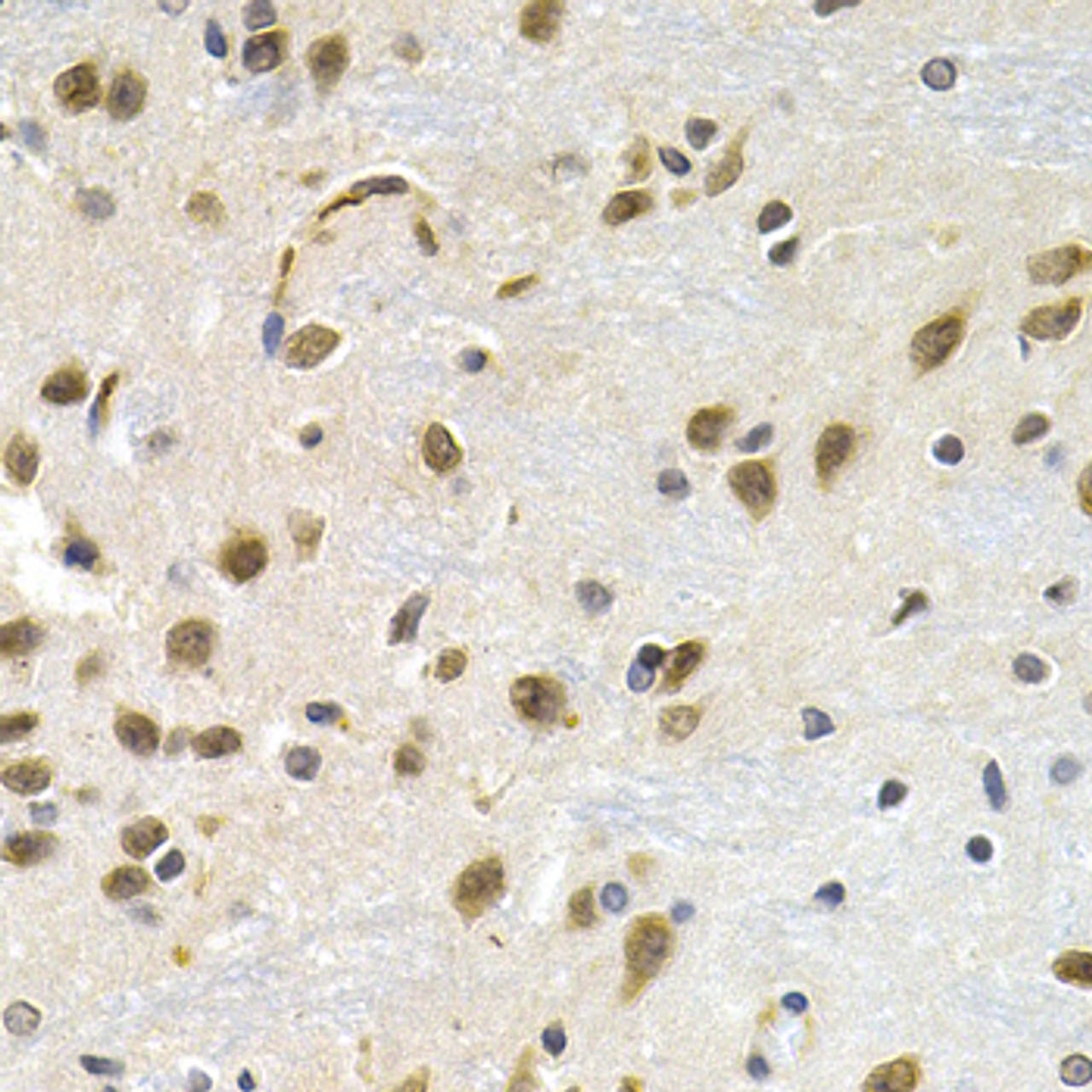 Immunohistochemistry of paraffin-embedded rat brain using LBR antibody (19-682) at dilution of 1:200 (40x lens) .